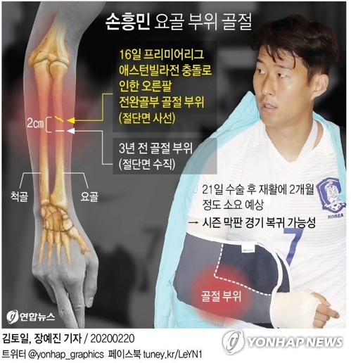손흥민, 오른팔 골절 부위 수술…핀으로 고정…주말까지 입원